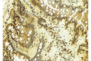 ABIN6269045 at 1/100 staining Mouse colon tissue by IHC-P. (CHEK1 anticorps  (Internal Region))