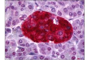 Immunohistochemistry (IHC) image for anti-Protein Tyrosine Phosphatase, Receptor Type, N (PTPRN) antibody (ABIN954381)