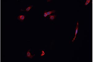 ABIN6268814 staining K-562 cells by IF/ICC. (KEAP1 anticorps)