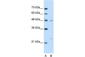 WB Suggested Anti-BSDC1 Antibody Titration:  2. (BSDC1 anticorps  (N-Term))