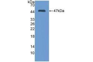 Detection of Recombinant MMP3, Mouse using Polyclonal Antibody to Matrix Metalloproteinase 3 (MMP3)