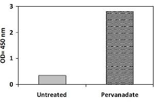 Image no. 3 for Receptor Tyrosine Kinase-Like Orphan Receptor 2 (ROR2) ELISA Kit (ABIN1981727)