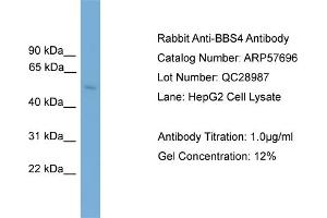 WB Suggested Anti-BBS4  Antibody Titration: 0. (BBS4 anticorps  (Middle Region))