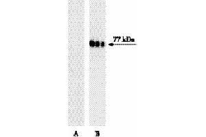 Western blot analysis of Btk (pY551) in human Burkitt’s lymphoma.