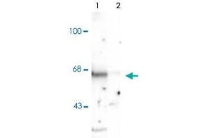 Western blot of rat cortex lysate showing specific immunolabeling of the ~65k Stxbp1 protein phosphorylated at Ser515. (STXBP1 anticorps  (pSer515))