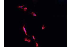 ABIN6268873 staining SHSY5Y? (DREAM anticorps  (Internal Region))