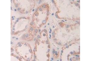 IHC-P analysis of Human Tissue, with DAB staining. (Angiopoietin 1 anticorps  (AA 21-228))