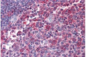 Human Tonsil: Formalin-Fixed, Paraffin-Embedded (FFPE)