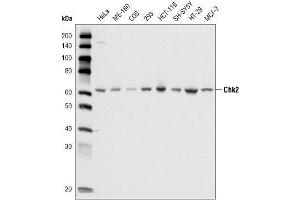Western blot analysis using CHK2 mouse mAb against cell lysate from various cell types. (CHEK2 anticorps  (AA 481-531))