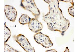 DDAH2 was detected in paraffin-embedded sections of human placenta tissues using rabbit anti- DDAH2 Antigen Affinity purified polyclonal antibody (Catalog # ) at 1 µg/mL.