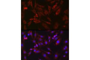 Immunofluorescence analysis of C6 cells using BDKRB1 Rabbit pAb (ABIN7265910) at dilution of 1:250 (40x lens).