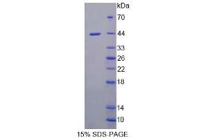 SDS-PAGE analysis of Mouse UQCRB Protein. (UQCRB Protéine)