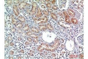 Immunohistochemical analysis of paraffin-embedded human-kidney, antibody was diluted at 1:200 (DPP4 anticorps  (Internal Region))