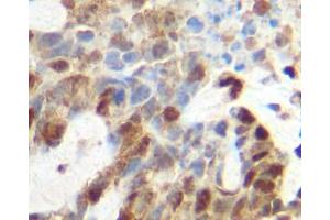 Image no. 2 for anti-Tumor Necrosis Factor alpha (TNF alpha) antibody (ABIN465605) (TNF alpha anticorps)