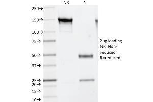 SDS-PAGE Analysis Purified Thymidylate Synthase Mouse Monoclonal Antibody (TS106). (TYMS anticorps)