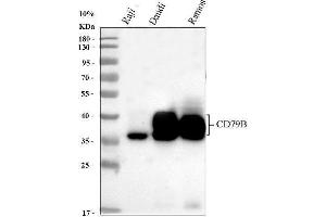 Western blot analysis of CD79b using anti-CD79b antibody (ABIN3043398). (CD79b anticorps  (AA 29-229))