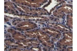 Detection of PMSA in Porcine Kidney Tissue using Polyclonal Antibody to Prostate-specific Membrane Antigen (PMSA)