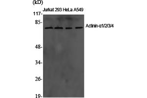Western Blotting (WB) image for anti-Actinin, alpha 1/2/3/4 (ACTN1/ACTN2/ACTN3/ACTN4) antibody (ABIN5960682)