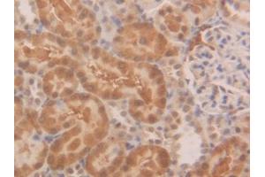 Detection of SOD1 in Rat Kidney Tissue using Polyclonal Antibody to Superoxide Dismutase 1 (SOD1) (SOD1 anticorps  (AA 2-154))