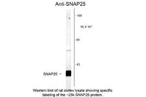 Image no. 1 for anti-Synaptosomal-Associated Protein, 25kDa (SNAP25) antibody (ABIN956767) (SNAP25 anticorps)