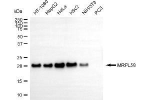 anti-Peptidyl-tRNA Hydrolase ICT1, Mitochondrial antibody