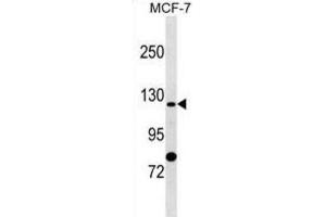Western Blotting (WB) image for anti-Solute Carrier Family 4, Sodium Bicarbonate Cotransporter, Member 9 (SLC4A9) antibody (ABIN2999782) (SLC4A9 anticorps)