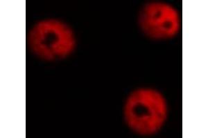 ABIN6267539 staining A549 cells by ICC/IF.