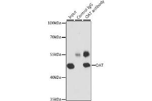 Immunoprecipitation analysis of 200 μg extracts of MCF-7 cells, using 3 μg OAT antibody (ABIN6127442, ABIN6144985, ABIN6144986 and ABIN6221831).