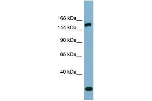 WB Suggested Anti-EPRS  Antibody Titration: 0. (EPRS anticorps  (Middle Region))