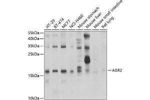 Western blot analysis of extracts of various cell lines, using  antibody (ABIN6131176, ABIN6136646, ABIN6136647 and ABIN6222857) at 1:1000 dilution. (AGR2 anticorps  (AA 21-175))