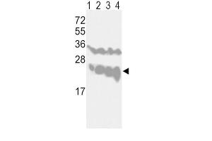 Western Blotting (WB) image for anti-Ubiquitin Carboxyl-terminal Esterase L1 (Ubiquitin Thiolesterase) (UCHL1) antibody (ABIN3001459) (UCHL1 anticorps)