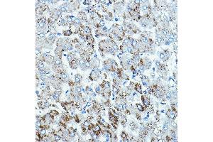 Immunohistochemistry of paraffin-embedded human liver using B-Raf Rabbit pAb (ABIN7265818) at dilution of 1:100 (40x lens).