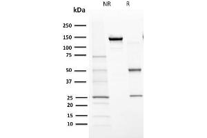 SDS-PAGE Analysis Purified Cytochrome P450 1A1/1A2 Mouse Monoclonal Antibody (MC1). (CYP1A1/2 anticorps)
