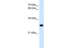 Western Blotting (WB) image for anti-Homeobox A7 (HOXA7) antibody (ABIN2463109) (HOXA7 anticorps)