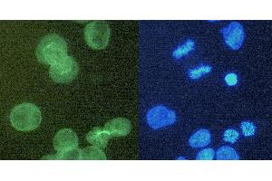 Immunocytochemistry staining of alpha-tubulin in K562 cells using purified rat monoclonal antibody YOL1/34 (concentration in sample 6 μg/mL, DAR FITC, left picture) vs.