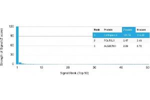 Analysis of Protein Array containing more than 19,000 full-length human proteins using Cathepsin K Mouse Monoclonal Antibody (CTSK/2793) Z- and S- Score: The Z-score represents the strength of a signal that a monoclonal antibody (MAb) (in combination with a fluorescently-tagged anti-IgG secondary antibody) produces when binding to a particular protein on the HuProtTM array. (Cathepsin K anticorps  (AA 163-274))