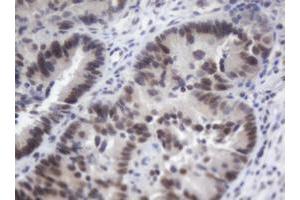 Image no. 3 for anti-Adrenocortical Dysplasia Homolog (ACD) antibody (ABIN1496406)