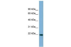 WB Suggested Anti-FNDC4 Antibody Titration:  0. (FNDC4 anticorps  (Middle Region))