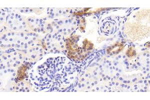 Detection of EFNB2 in Human Kidney Tissue using Polyclonal Antibody to Ephrin B2 (EFNB2) (Ephrin B2 anticorps)