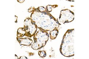 Immunohistochemistry of paraffin-embedded Human placenta using Cytokeratin 19 (KRT19) antibody (ABIN7268099) at dilution of 1:100 (40x lens). (Cytokeratin 19 anticorps)