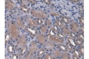 IHC-P analysis of Rat Kidney Tissue, with DAB staining. (ANGPTL4 anticorps  (AA 228-389))
