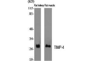 Western Blotting (WB) image for anti-TIMP Metallopeptidase Inhibitor 4 (TIMP4) (C-Term) antibody (ABIN3177728) (TIMP4 anticorps  (C-Term))