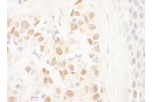 Immunohistochemistry (IHC) image for anti-DDB1 and CUL4 Associated Factor 6 (DCAF6) (AA 600-650) antibody (ABIN7448700)