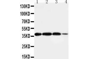 Anti-Arg2 antibody, Western blotting Lane 1: Rat Lung Tissue Lysate Lane 2: Rat Testis Tissue Lysate Lane 3: A549 Cell Lysate Lane 4:293T Cell Lysate (ARG2 anticorps  (N-Term))