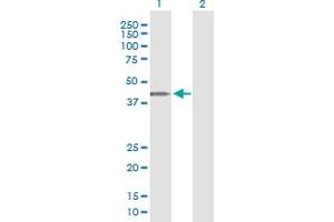 Western Blot analysis of ARMCX3 expression in transfected 293T cell line by ARMCX3 monoclonal antibody (M01), clone 2G3. (ARMCX3 anticorps  (AA 278-379))