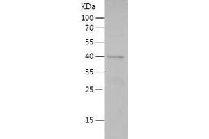 Western Blotting (WB) image for Lectin, Galactoside-Binding, Soluble, 9 (LGALS9) (AA 1-183) protein (His-IF2DI Tag) (ABIN7123736) (Galectin 9 Protein (AA 1-183) (His-IF2DI Tag))