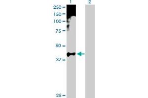 Western Blot analysis of HOXA11 expression in transfected 293T cell line by HOXA11 MaxPab polyclonal antibody. (Homeobox A11 anticorps  (AA 1-313))