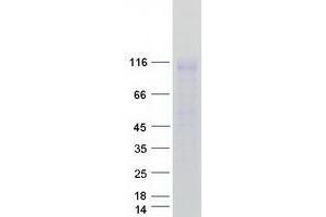 Validation with Western Blot