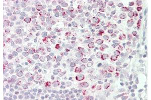 Rabbit Anti-CSTF2 antibody  Formalin Fixed Paraffin Embedded Tissue: Human Tonsil Primary antibody Concentration: 1:100 Secondary Antibody: Donkey anti-Rabbit-Cy3 Secondary Antibody Concentration: 1:200 Magnification: 20x Exposure Time: 0.