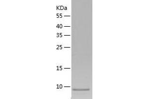 Western Blotting (WB) image for Lymphocyte Antigen 6 Complex, Locus G6D (LY6G6D) (AA 20-104) protein (His tag) (ABIN7123801)